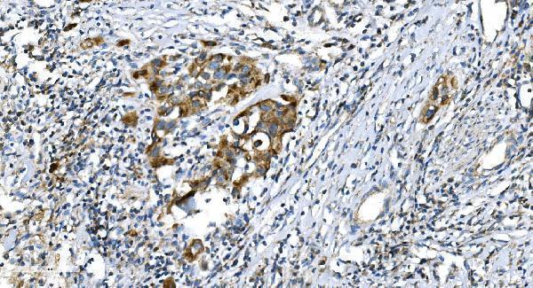 a00556 2 dnm1l primary antibodies ihc testing 4