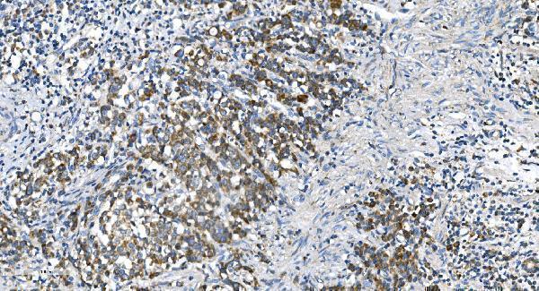 a00556 2 dnm1l primary antibodies ihc testing 5