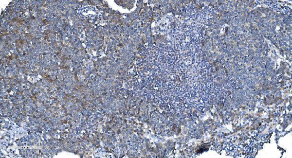 a00556 2 dnm1l primary antibodies ihc testing 6