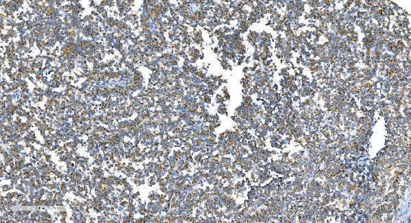 a00556 2 dnm1l primary antibodies ihc testing 7