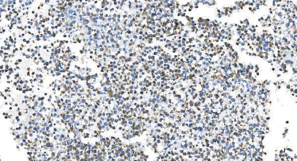 a00556 2 dnm1l primary antibodies ihc testing 9
