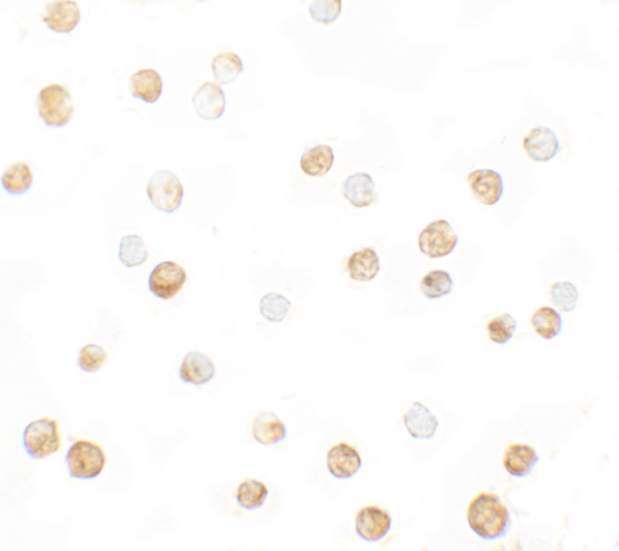 Immunocytochemistry of DNM1L in HeLa cells with DNM1L antibody at 5 μg/mL
