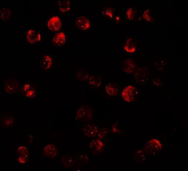 Immunofluorescence of DNM1L in HeLa cells with DNM1L antibody at 20 μg/mL