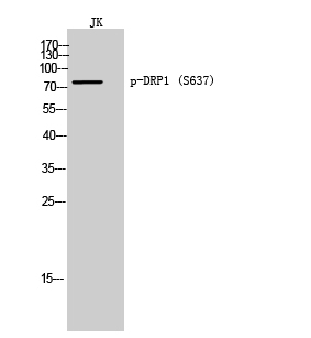 Western Blot analysis of JK cells using Phospho-DRP1 (S637) Polyclonal Antibody