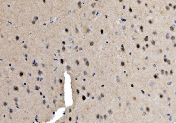 a00557 1 srf primary antibodies ihc testing 2