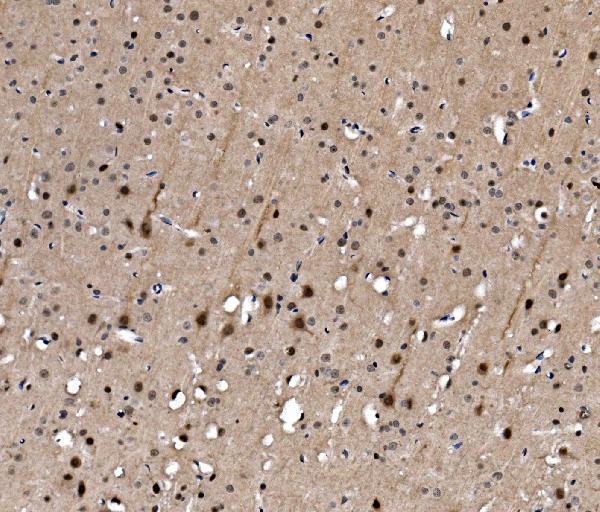 a00557 1 srf primary antibodies ihc testing 3