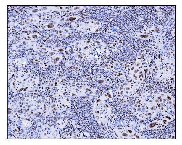 a00557 2 srf primary antibodies ihc testing 5