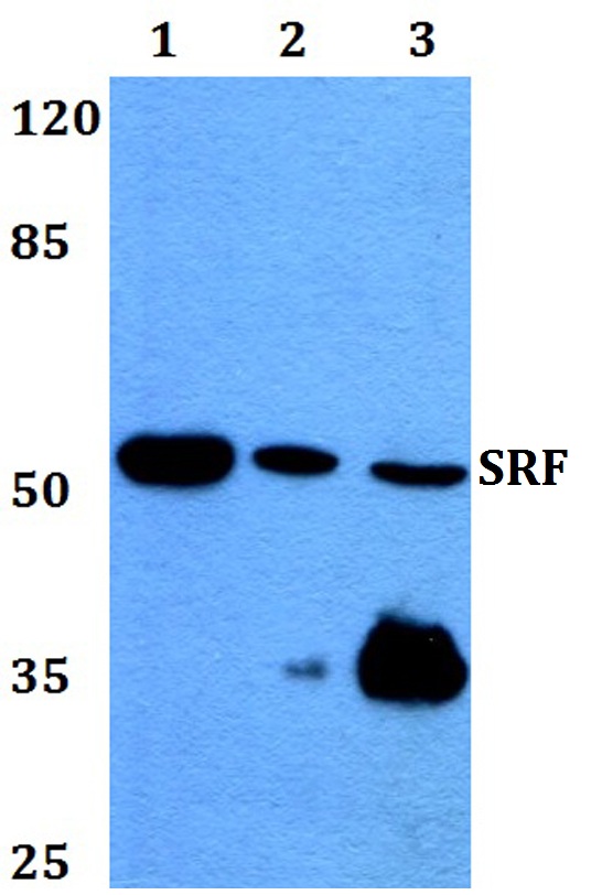a00557 srf primary antiboties wb testing 1