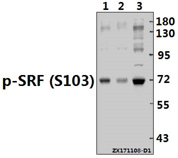 Western blot (WB) analysis of SRF (phospho-S103) polyclonal antibody at 1:500 dilution
Lane1:H1792 whole cell lysate(40ug)
Lane2:SK-OVCAR3 whole cell lysate(40ug)
Lane3:HEK293T whole cell lysate(40ug)