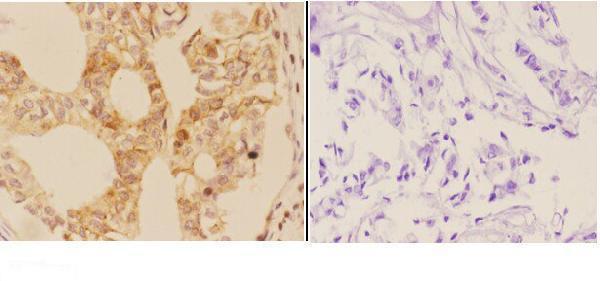 a00558 3 aire primary antiboties ihc testing 2