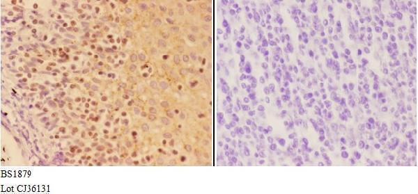 a00558 3 aire primary antiboties ihc testing 3
