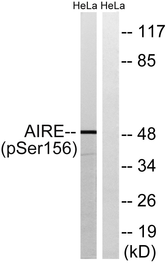 a00558s156 aire primary antibodies wb testing 1