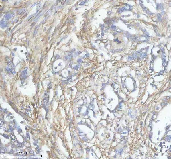 IHC analysis of FBN1 using anti-FBN1 antibody (A00559-1)