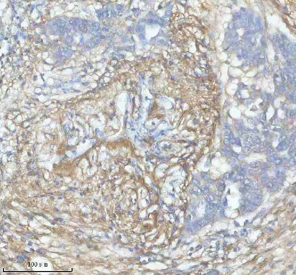 IHC analysis of FBN1 using anti-FBN1 antibody (A00559-1)