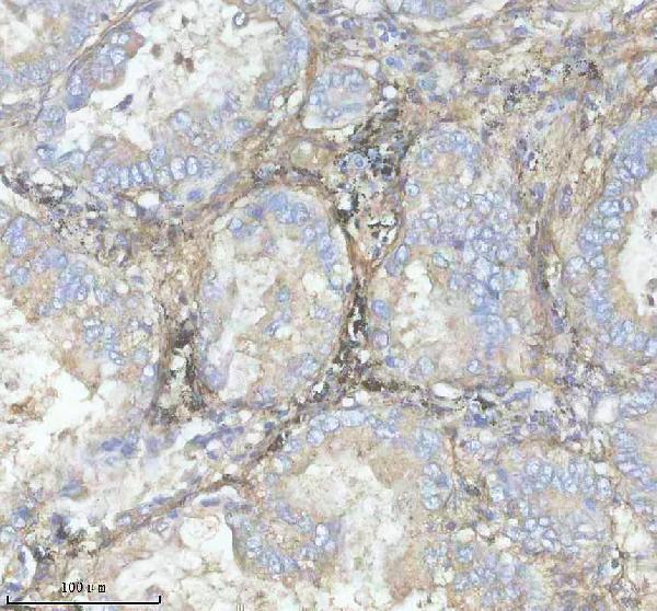 a00559 1 fbn1 primary antibodies ihc testing 4