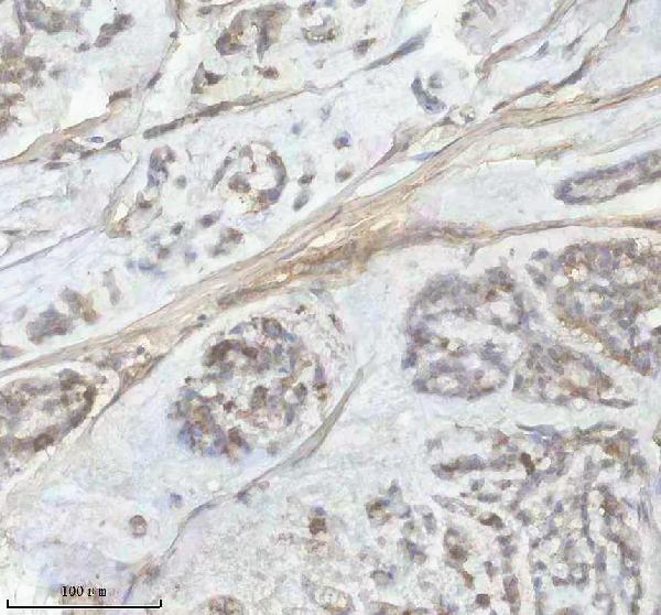 a00559 1 fbn1 primary antibodies ihc testing 5