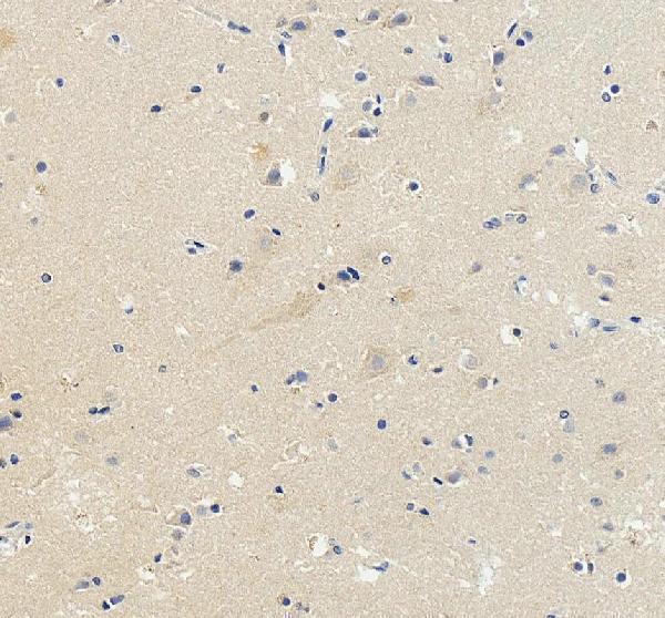 a00560 dcc primary antibodies ihc testing 5