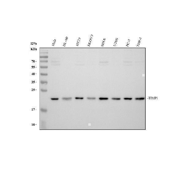Western blot analysis of TIMP1 using anti-TIMP1 antibody (A00561)