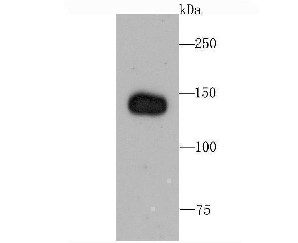 Western blot analysis of Factor H on human lung tissue lysate using anti-Factor H antibody at 1/1,000 dilution