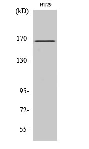 Western Blot analysis of various cells using FANCD2 Polyclonal Antibody diluted at 1:500 cells nucleus extracted by Minute TM Cytoplasmic and Nuclear Fractionation kit 
