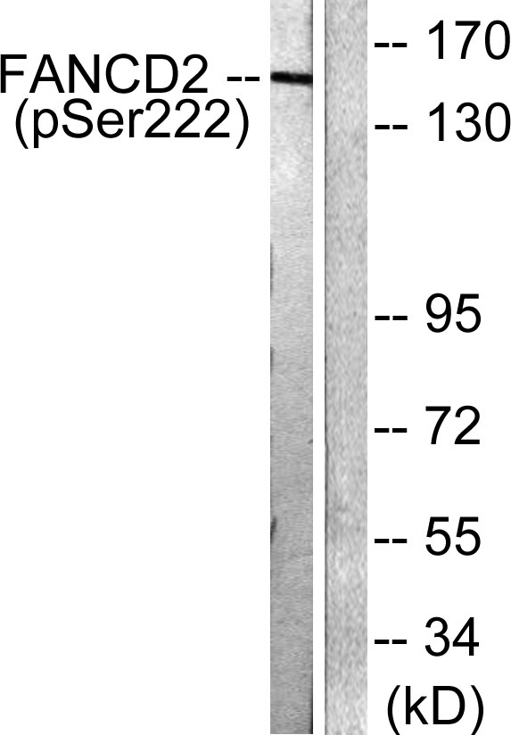 Western blot analysis of lysates from HT29 cells treated with Calyculin A 50ng/ml 30', using FANCD2 (Phospho-Ser222) Antibody