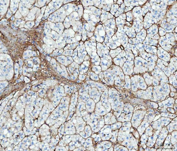 a00564 1 fn1 primary antibodies ihc testing 2