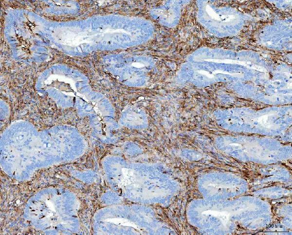 a00564 1 fn1 primary antibodies ihc testing 3