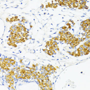 a00564 fn1 primary antiboties ihc testing 2