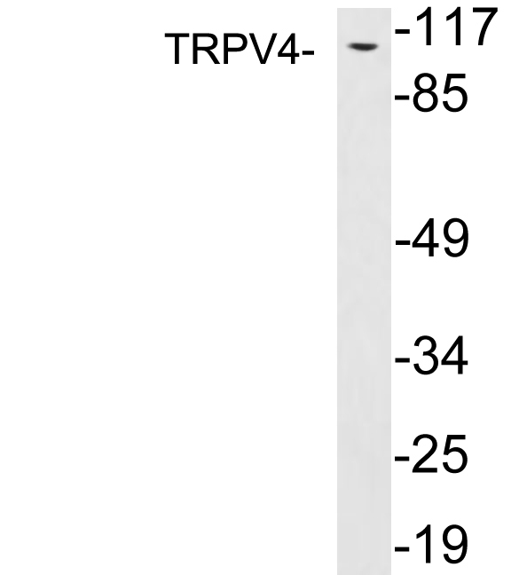 Western blot analysis of lysates from PC12 cells, using TRPV4 antibody