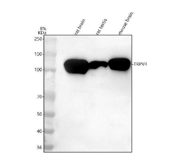  Western blot analysis of TRPV4 using anti-TRPV4 antibody (A00565-3)