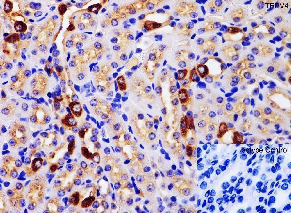 a00565 trpv4 primary antibodies ihc testing 2_1