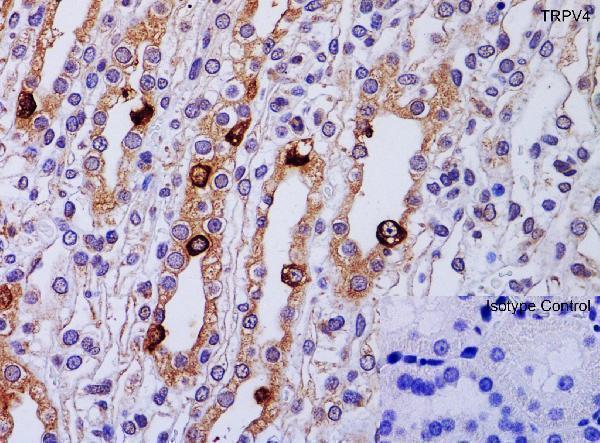 a00565 trpv4 primary antibodies ihc testing 3