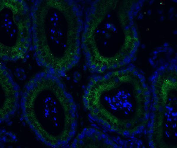a00566 2 adam10 primary antibodies if testing 10
