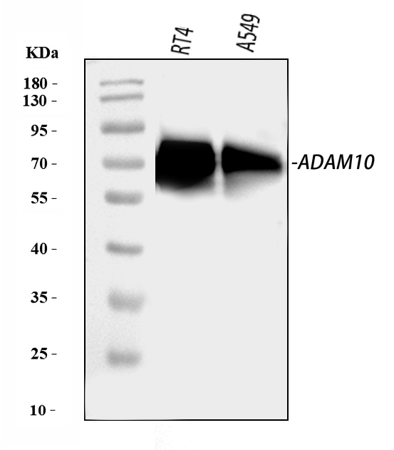  Western blot analysis of ADAM10 using anti-ADAM10 antibody (A00566-5)