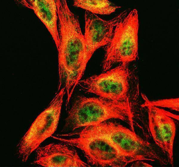  IF analysis of SGT1/ECD using anti-SGT1/ECD antibody (A00567-2) and anti-Tubulin Alpha antibody (M03989-3)