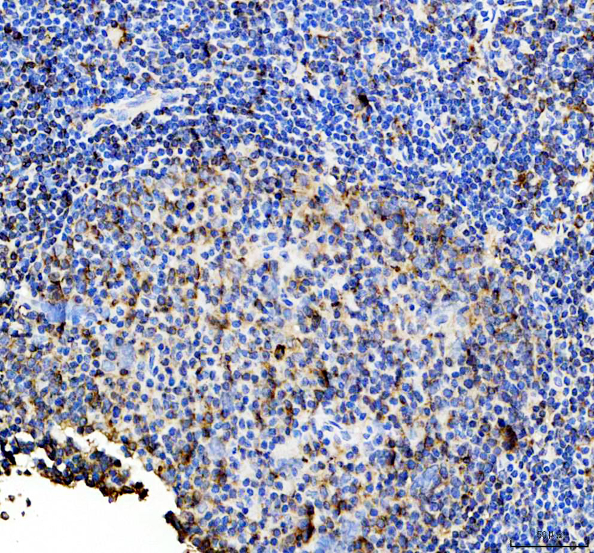 IHC analysis of HLA-DRB1 using anti-HLA-DRB1 antibody (A00568)