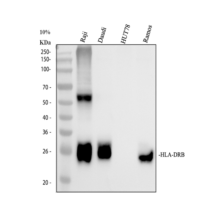Western blot analysis of HLA-DRB1 using anti-HLA-DRB1 antibody (A00568)