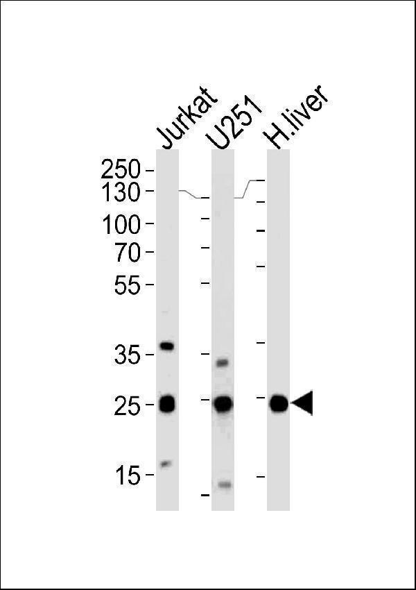 Western blot analysis of lysates from Jurkat, U251 cell line and human liver tissue (from left to right), using GSTM1 Antibody (C-term) 