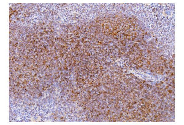 a00570 1 cd2 primary antibodies ihc testing 1