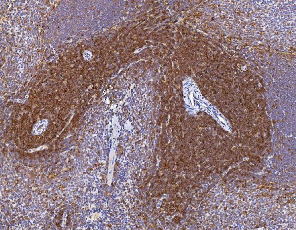a00570 1 cd2 primary antibodies ihc testing 2