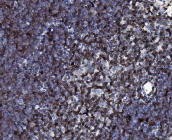  IHC analysis of Cd2 using anti-Cd2 antibody (A00570-2)