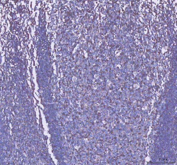 IHC analysis of CD2 using anti-CD2 antibody (A00570-3)
