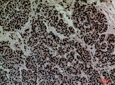 Immunohistochemistry validation of CD2 using Anti-T-cell surface antigen CD2 CD2 Antibody (A00570)