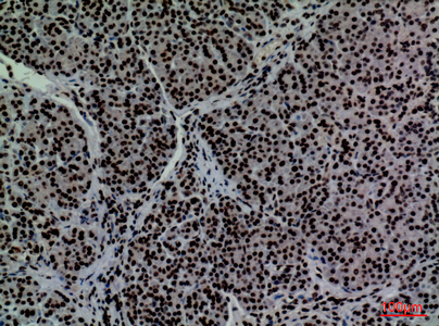 Immunohistochemistry validation of CD2 using Anti-T-cell surface antigen CD2 CD2 Antibody (A00570)