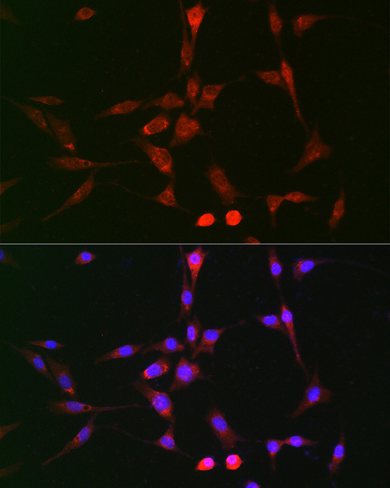 a00575 lox primary antiboties if testing 2