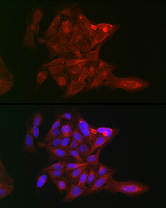 a00575 lox primary antiboties if testing 4