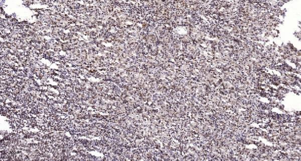 Immunohistochemical analysis of paraffin-embedded human spleen
