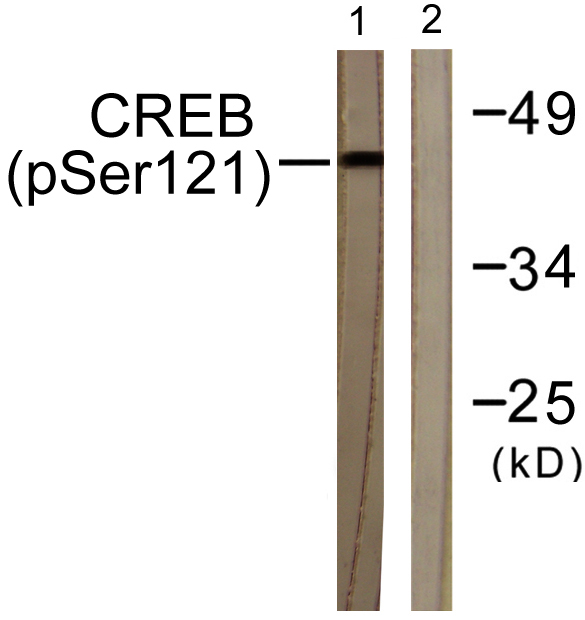 Western blot analysis of lysates from HeLa cells treated with Etoposide 25uM 24h, using CREB (Phospho-Ser121) Antibody