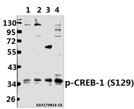 Western blot (WB) analysis of p-CREB-1 (S129) pAb at 1:500 dilution
Lane1:A375 whole cell lysate(40ug)
Lane2:MCF-7 whole cell lysate(40ug)
Lane3:The Brain tissue lysate of Rat(40ug)
Lane4:BV2 whole cell lysate(40ug)