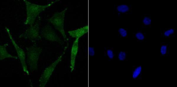 ICC staining Phospho-Creb (S133) in SH-SY-5Y cells (green)